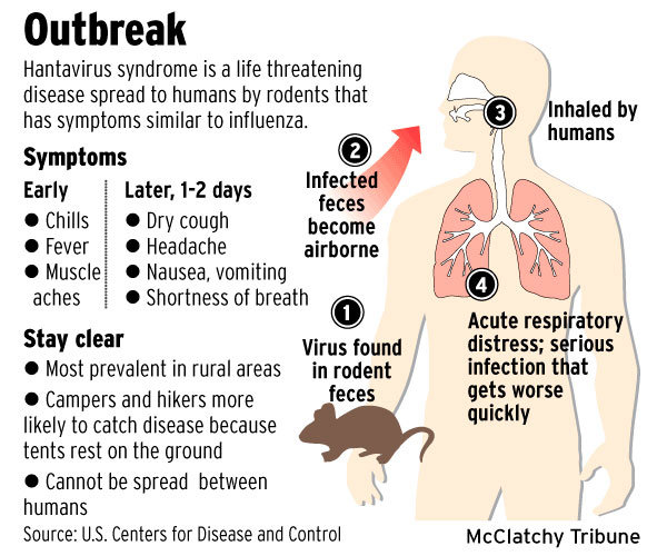 Hantavirus info